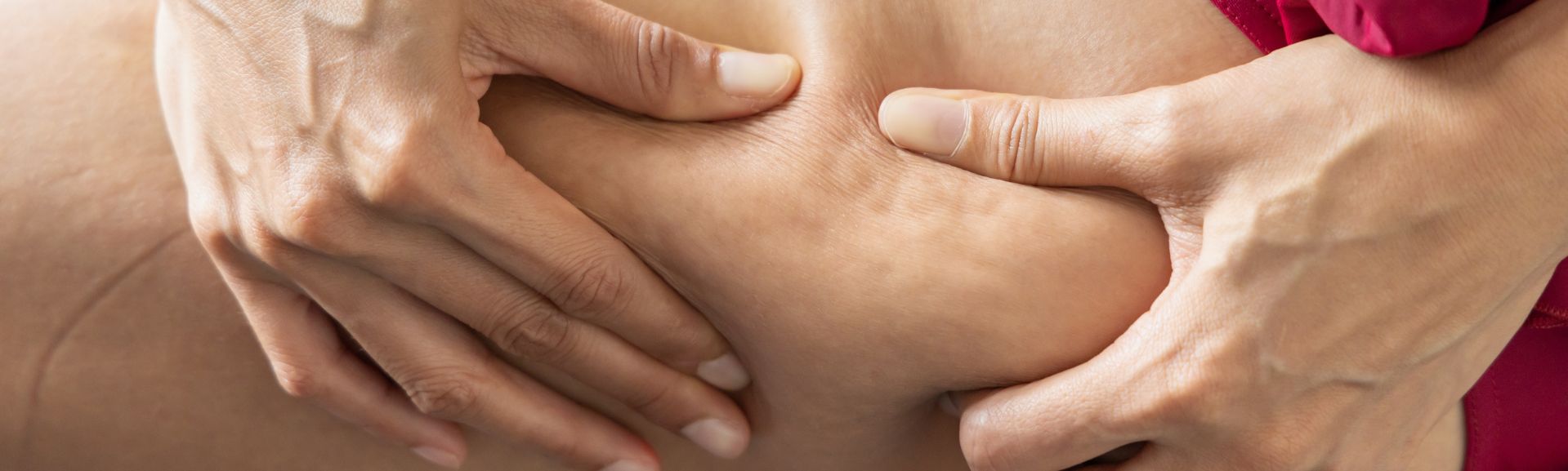 Rétention d'eau cellulite femmes minces